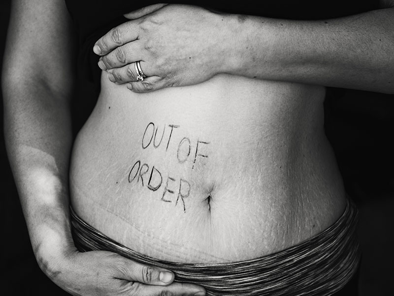 Photo noir et blanc d'un ventre sur lequel est écrit "out of order"